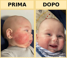 finally stop your baby's endless scratching with SeneritePelle