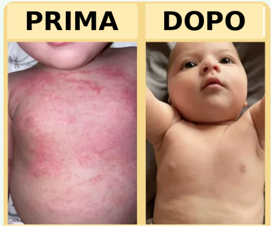 finally stop your baby's endless scratching with SeneritePelle