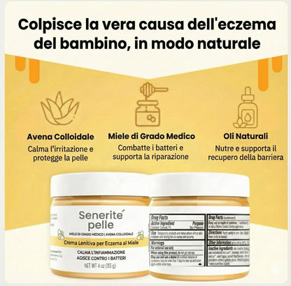 finalmente metti fine ai graffi infiniti del tuo bambino con SeneritePelle